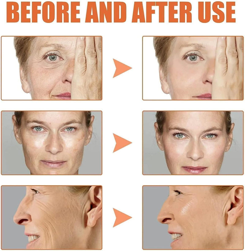 Botox Stock Solution Suero Antiarrugas